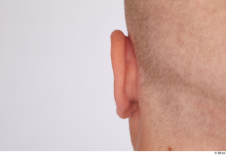 Jerome ear 0003.jpg